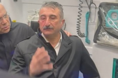 CHP Bursa İl Başkanı Yeşiltaş eylemlerde yaralandı!