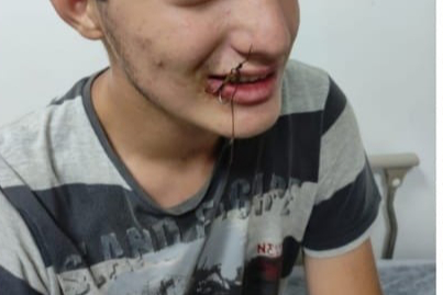 Bu kez oltaya çocuk takıldı