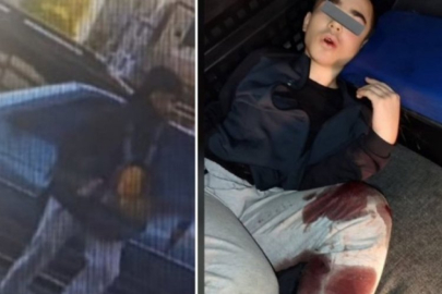 Polislerimizi şehit eden saldırgan hastanede öldü!