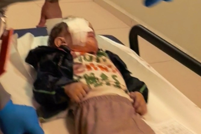 Bursa'da torpil patladı: 2 yaşındaki çocuk görme yetisini kaybetti!