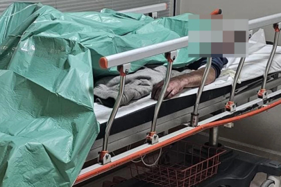 Bursa'da yaktığı ateşde  yandı