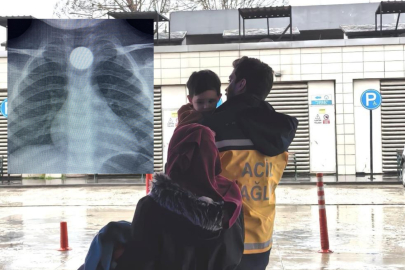 Bursa'da küçük çocuğun boğazına 50 kuruş kaçtı