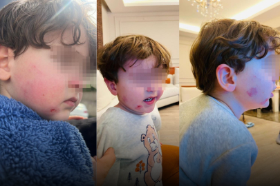 Kreşe bıraktığı çocuğunu darp edilmiş halde aldı