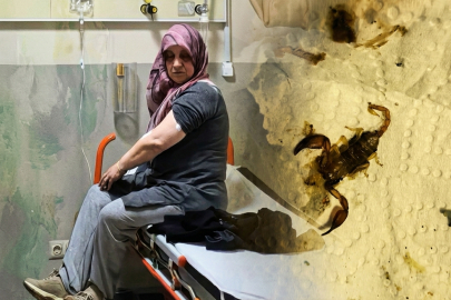 Bursa'da akrep sokan kadın hastanelik oldu!