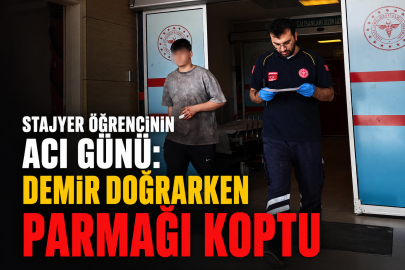 Stajyer Öğrencinin Acı Günü: Demir Doğrarken Parmağı Koptu